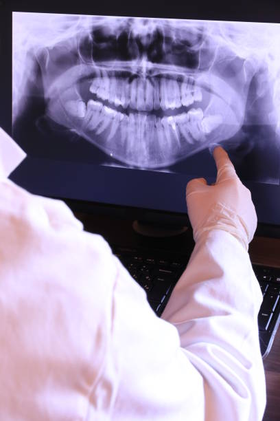 Best Emergency Tooth Extraction in La Fayette, AL